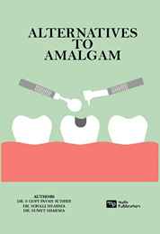Alternatives to Amalgam