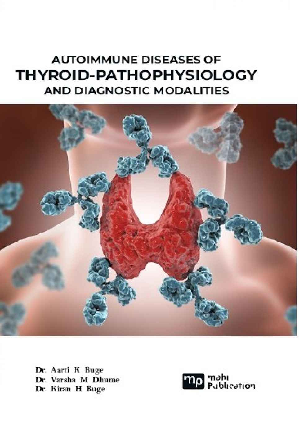 Autoimmune Diseases of Thyroid-pathophysiology And Diagnostic Modalities