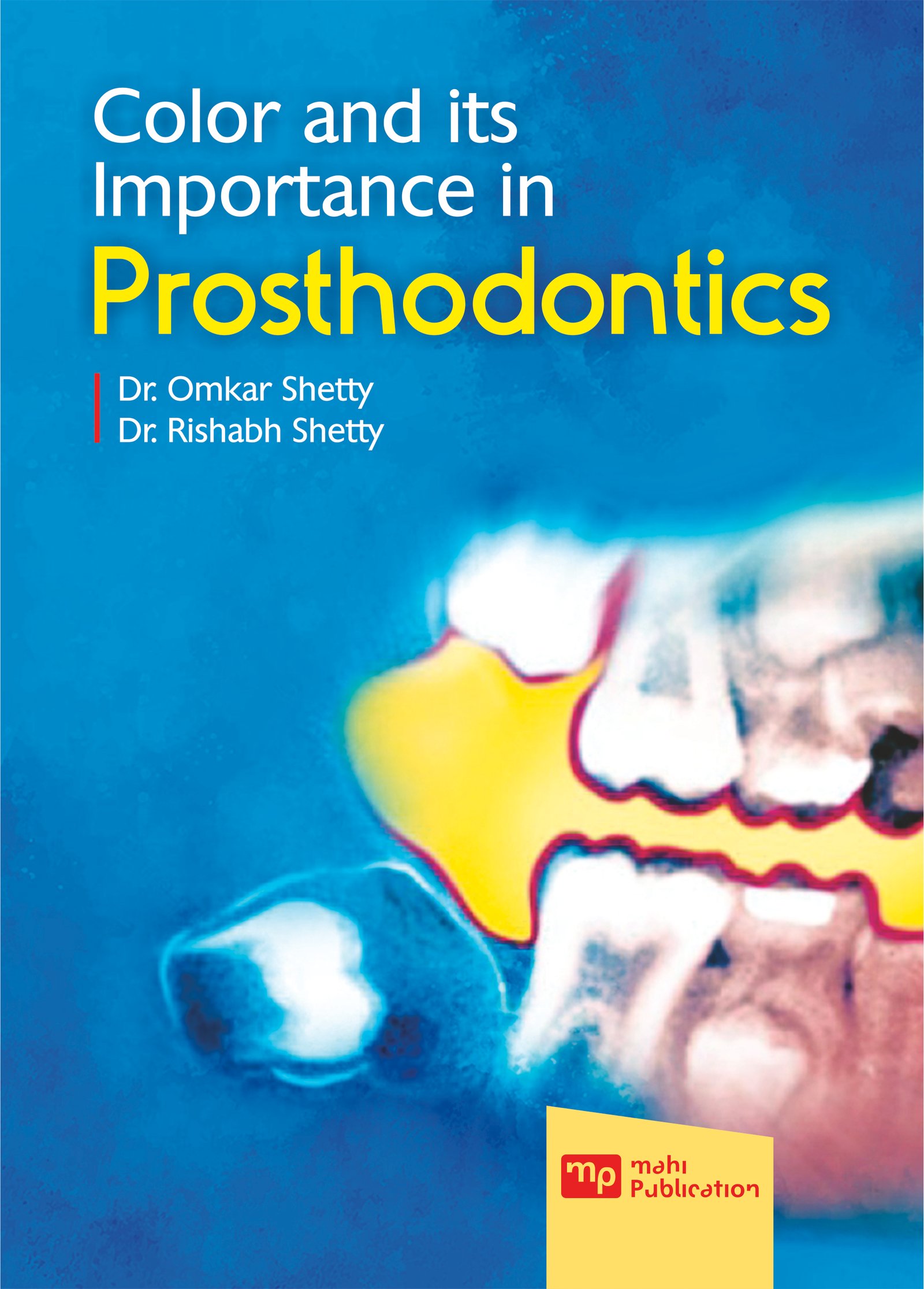 Color And Its Importance In Prosthodontics