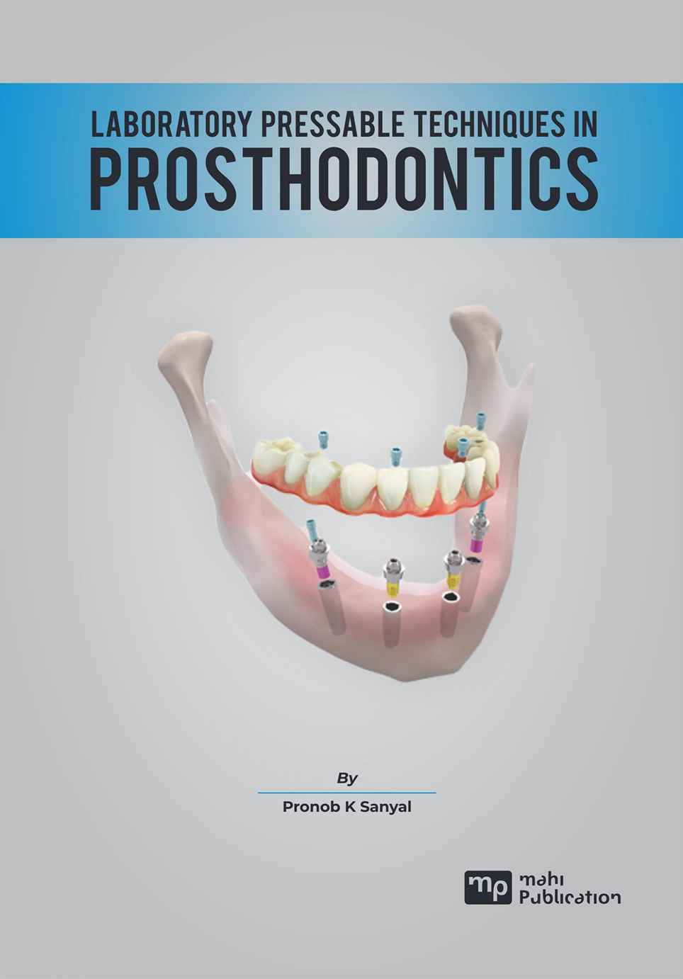 Laboratory Pressable Techniques In Prosthodontics