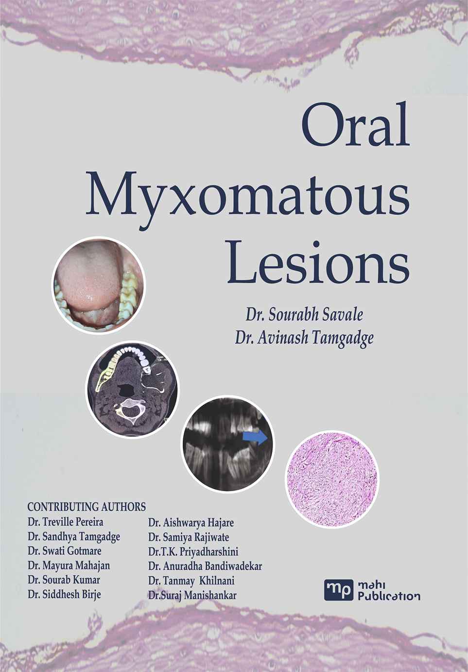 Oral Myxomatous Lesions