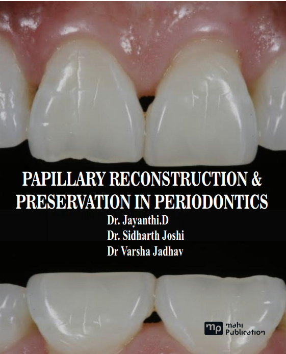 Papillary Reconstruction & Preservation In Periodontics