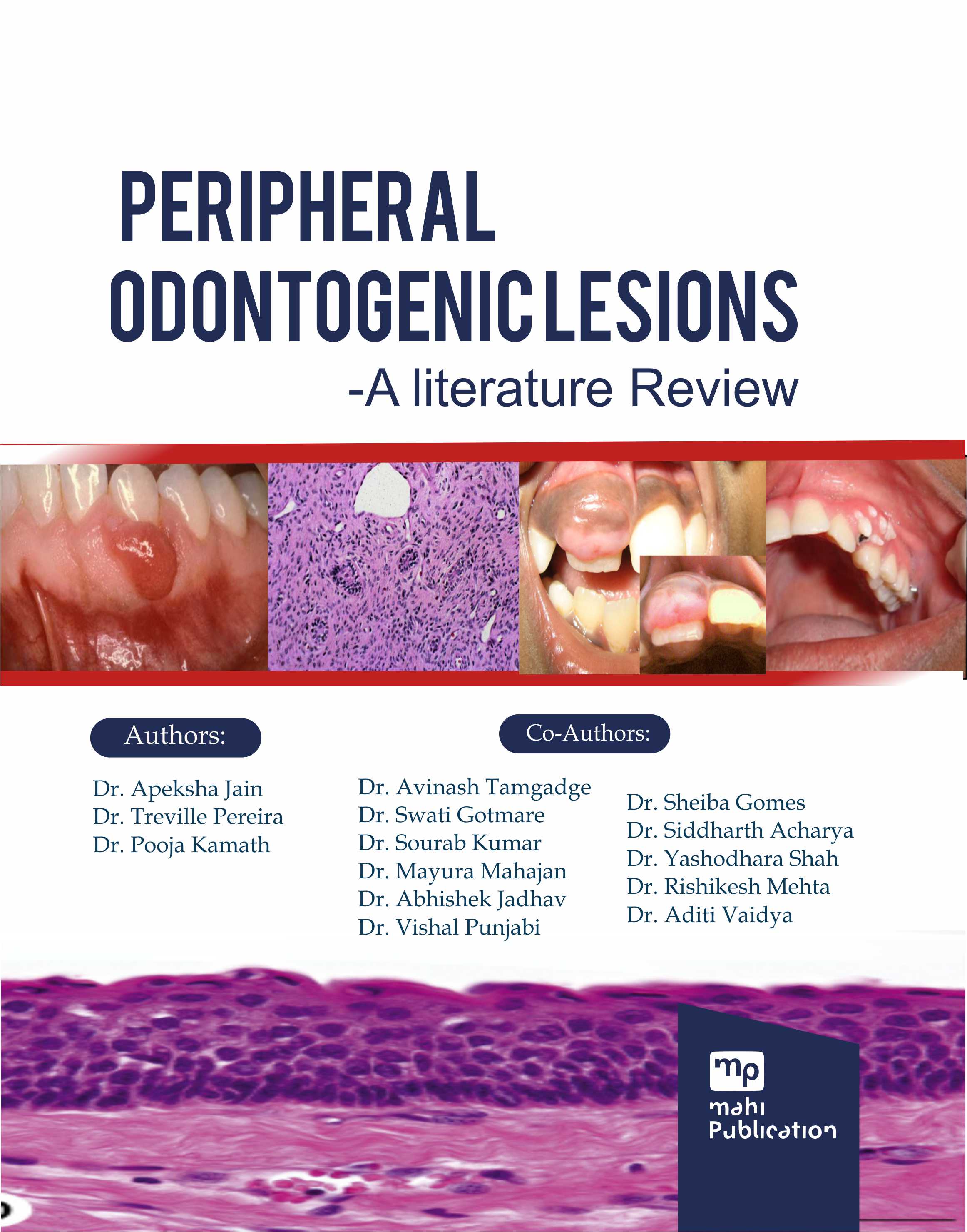 Peripheral Odontogenic Lesions - A Literature Review
