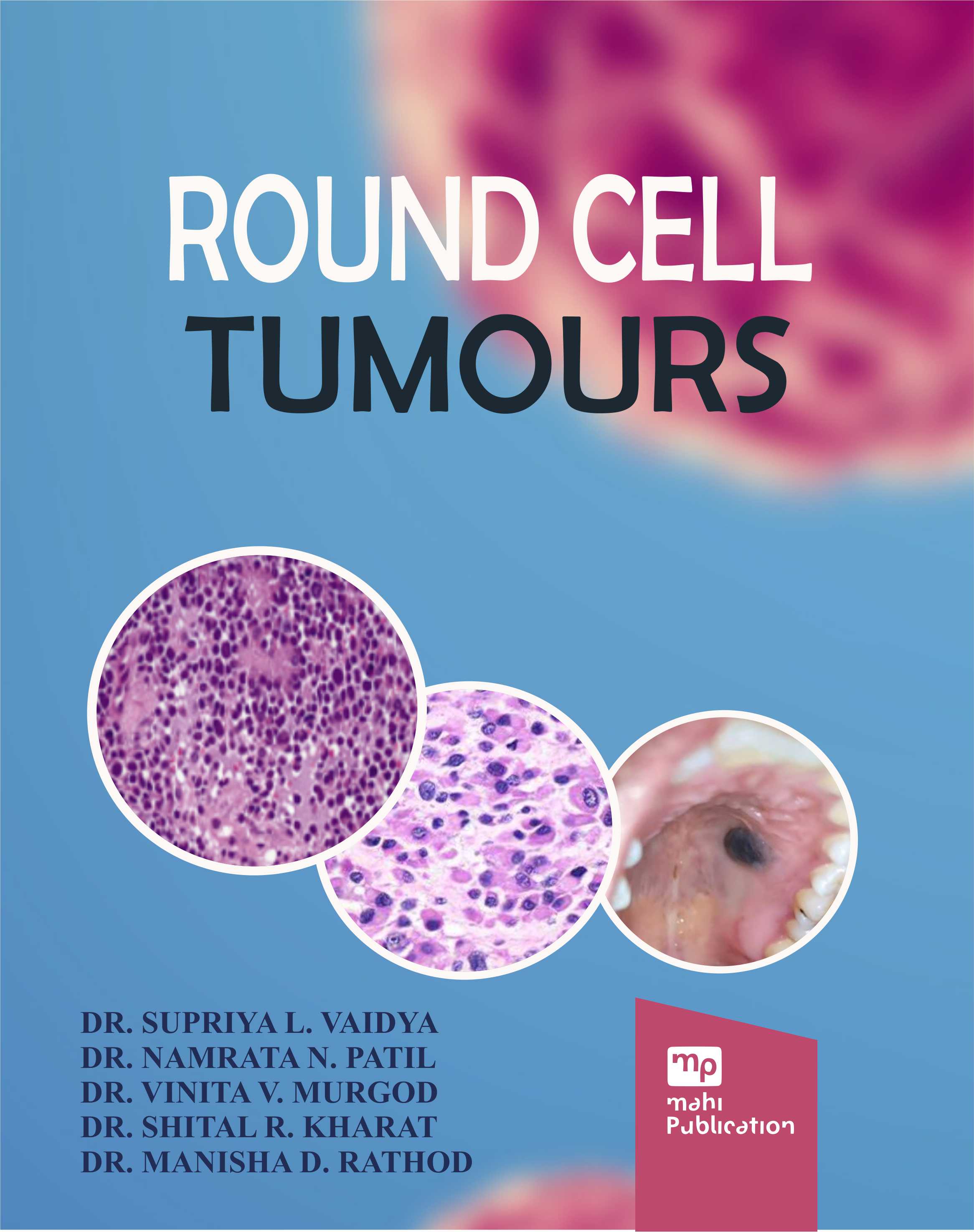 Round Cell Tumours